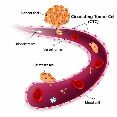 blood-stream-CTC-4 new.jpg